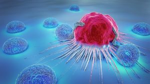 Lire la suite à propos de l’article Traitement Cancer du Col de l’Utérus : l’Essentiel à Savoir