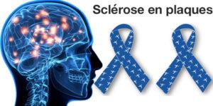 Sclérose en plaques traitement naturel