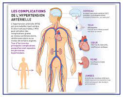 Hypertension manifestation et traitement.