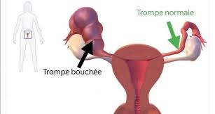 You are currently viewing Trompe bouchée qu’est-ce que c’est ?