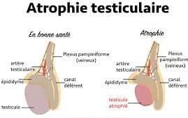 You are currently viewing Atrophie testiculaire traitement par plante médicinale