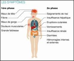 Fièvre Typhoïde symptômes