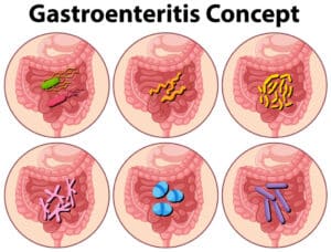 Lire la suite à propos de l’article Gastro-entérite cause symptôme et complication