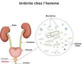 Lire la suite à propos de l’article Urétrite cause symptômes et complication