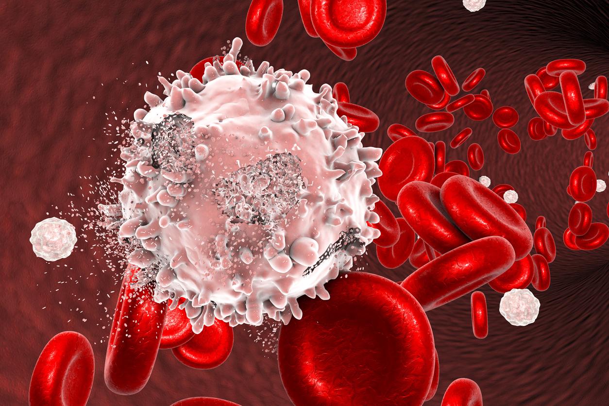 Lire la suite à propos de l’article La Leucémie : Causes et Traitements – Comprendre et Lutter contre ce Cancer du Sang
