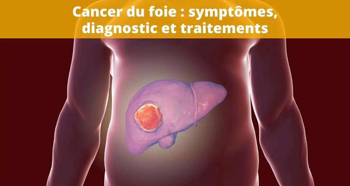 You are currently viewing Le cancer du foie : comprendre les causes, les symptômes et les traitements