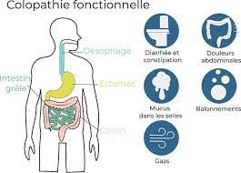 You are currently viewing Colopathie fonctionnelle tout savoir sur ce mal