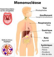 You are currently viewing Mononucléose : Tout ce qu’il faut savoir sur cette infection virale