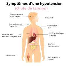 You are currently viewing L’Hypotension Artérielle : Comprendre, Symptômes, Causes et Traitement