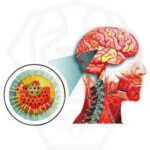 Encéphalite : Comprendre une Inflammation Cérébrale Potentiellement Grave